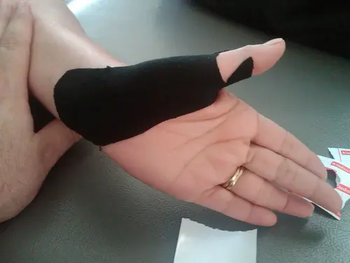 Tendinitis del abductor largo del pulgar