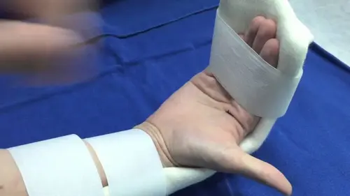 Tendinitis del músculo flexor superficial de los dedos