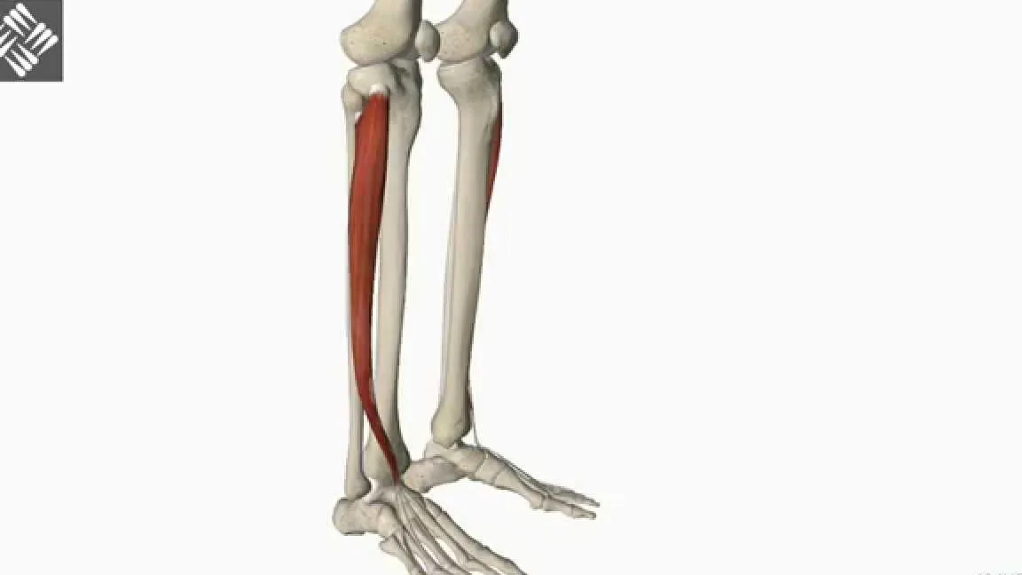Tendinitis del extensor común