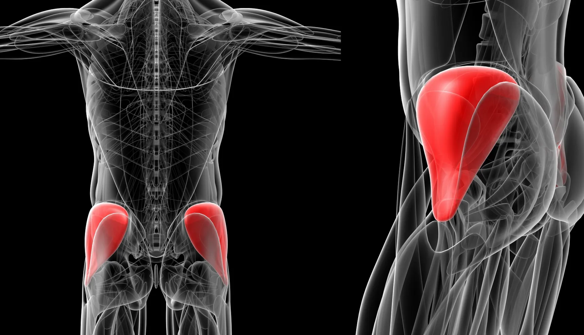 Diagnóstico de la tendinitis del glúteo medio