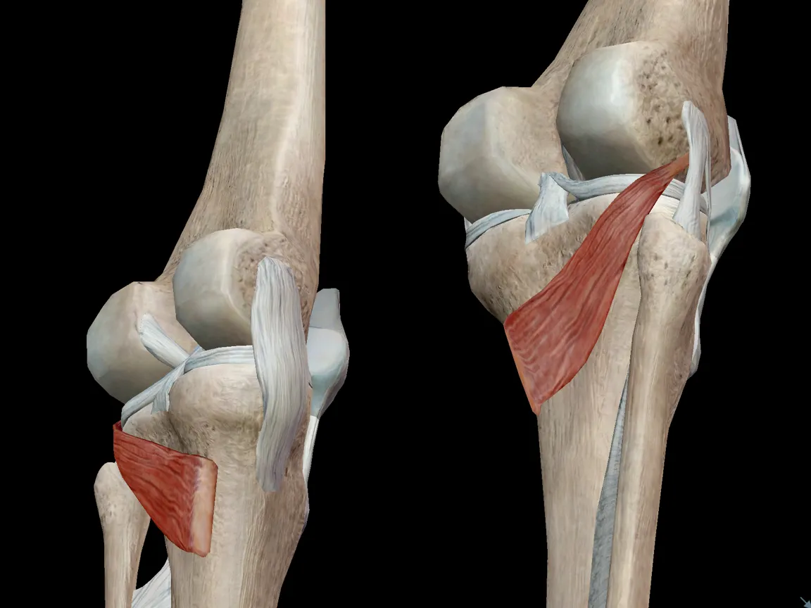 ¿Qué es la tendinitis del músculo poplíteo?