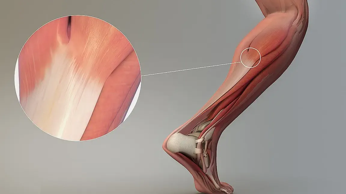 Introducción a la tendinitis del tendón rotuliano
